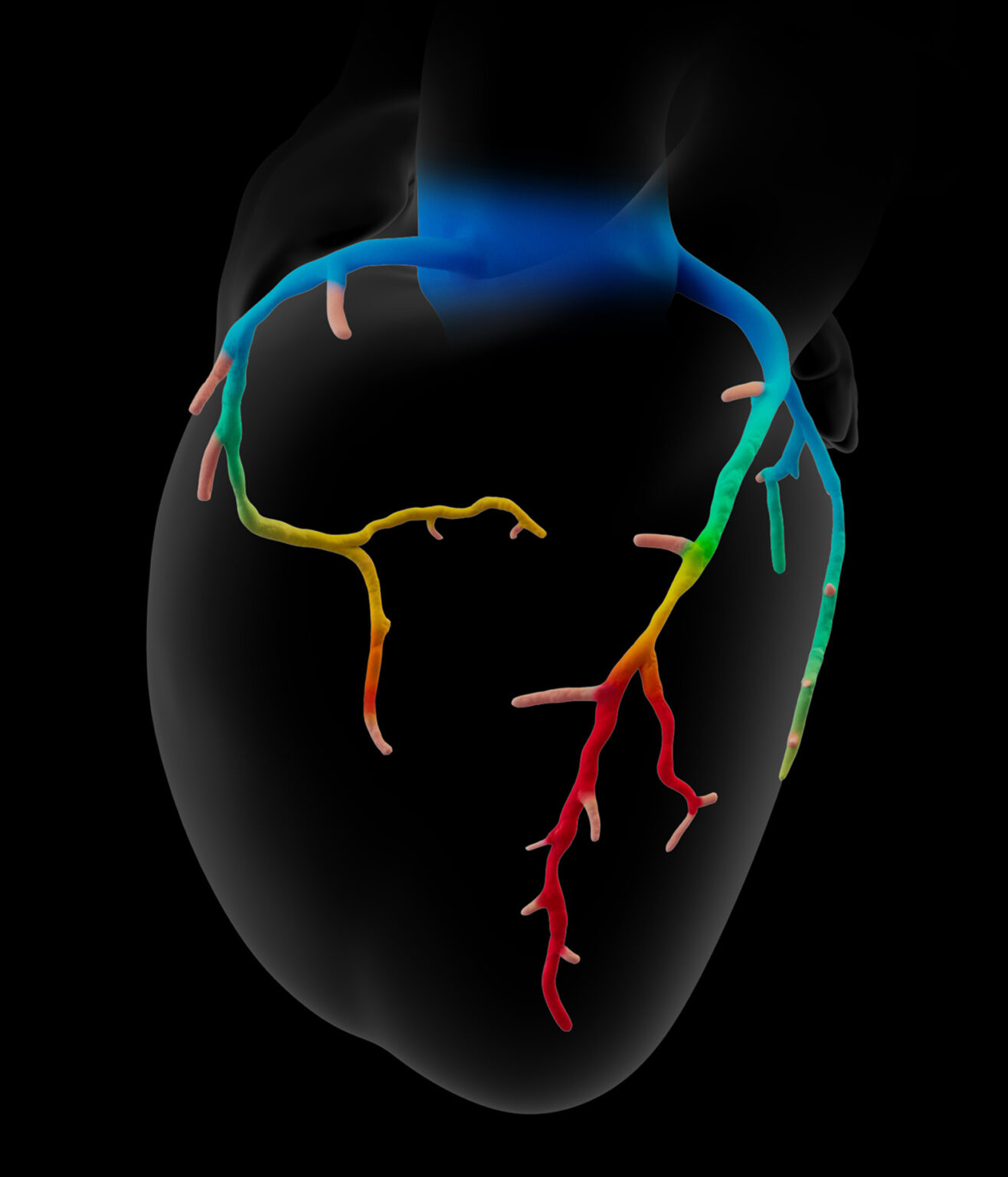 MyCardiologist Now Offers Heartflow Heart Imaging